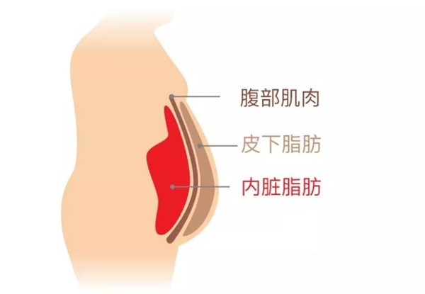 为您讲解:内脏脂肪要怎么减